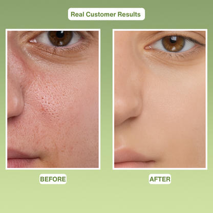 CLARIVASKIN GREEN TOMATO CLARIMASK™